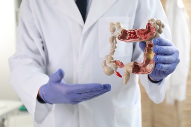 Photo of Doctor showing model of large intestine indoors, closeup