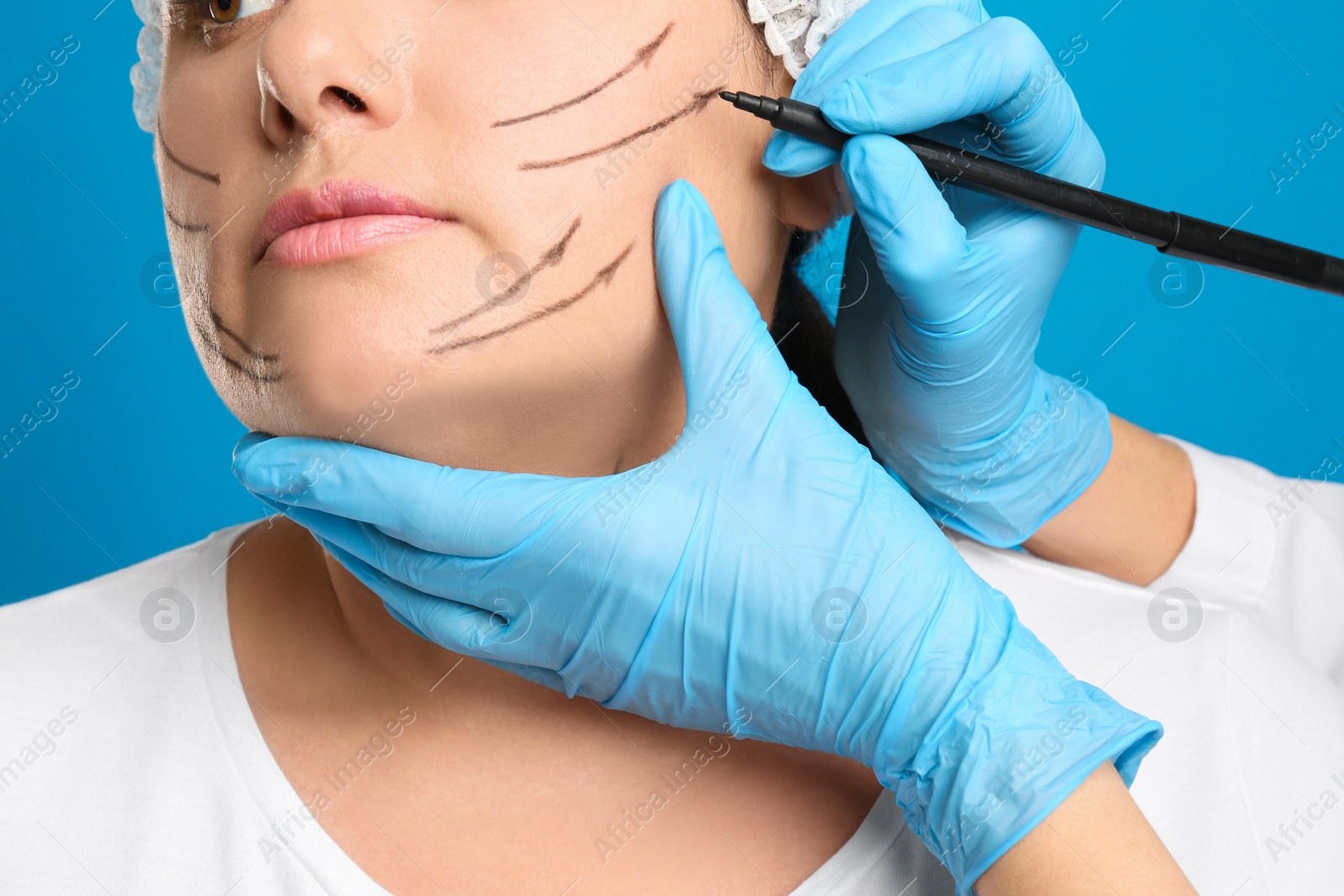 Photo of Doctor drawing marks on woman's face for cosmetic surgery operation against blue background, closeup. Double chin problem