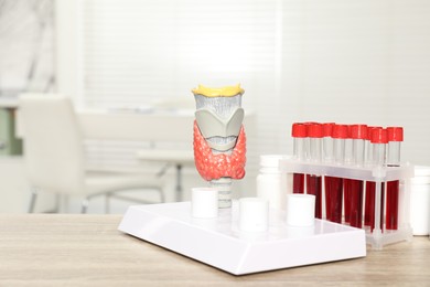 Photo of Endocrinology. Model of thyroid gland and blood samples in test tubes on table indoors