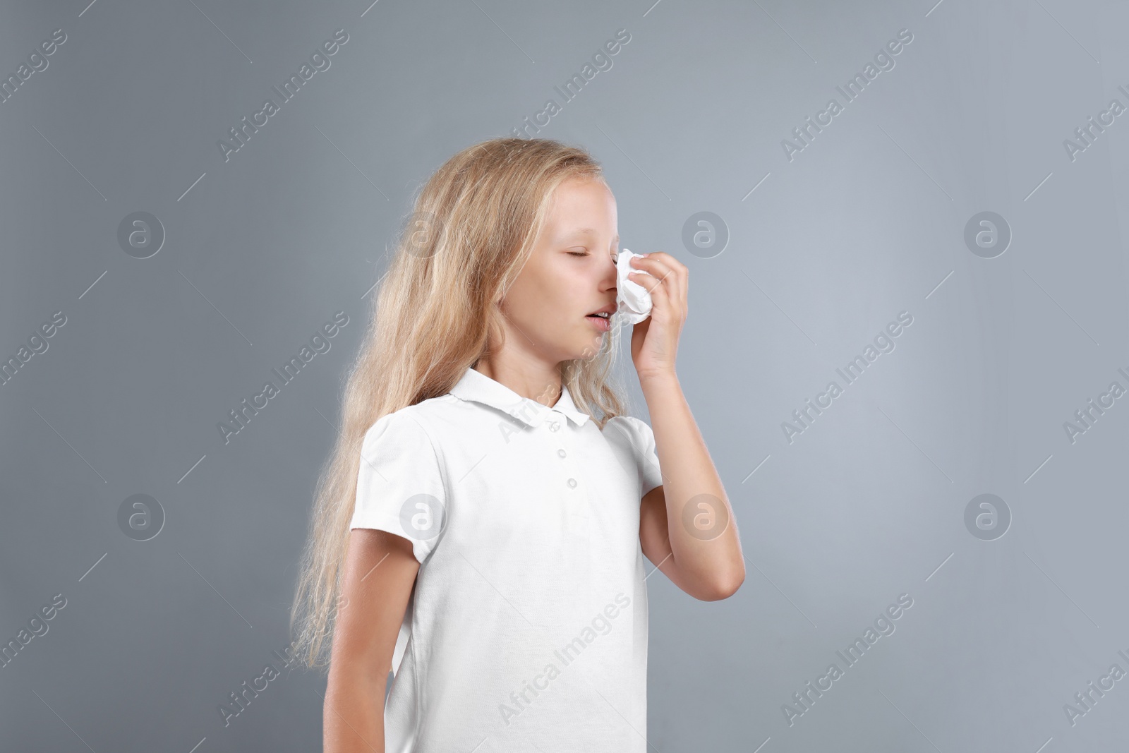 Photo of Little girl suffering from allergy on grey background