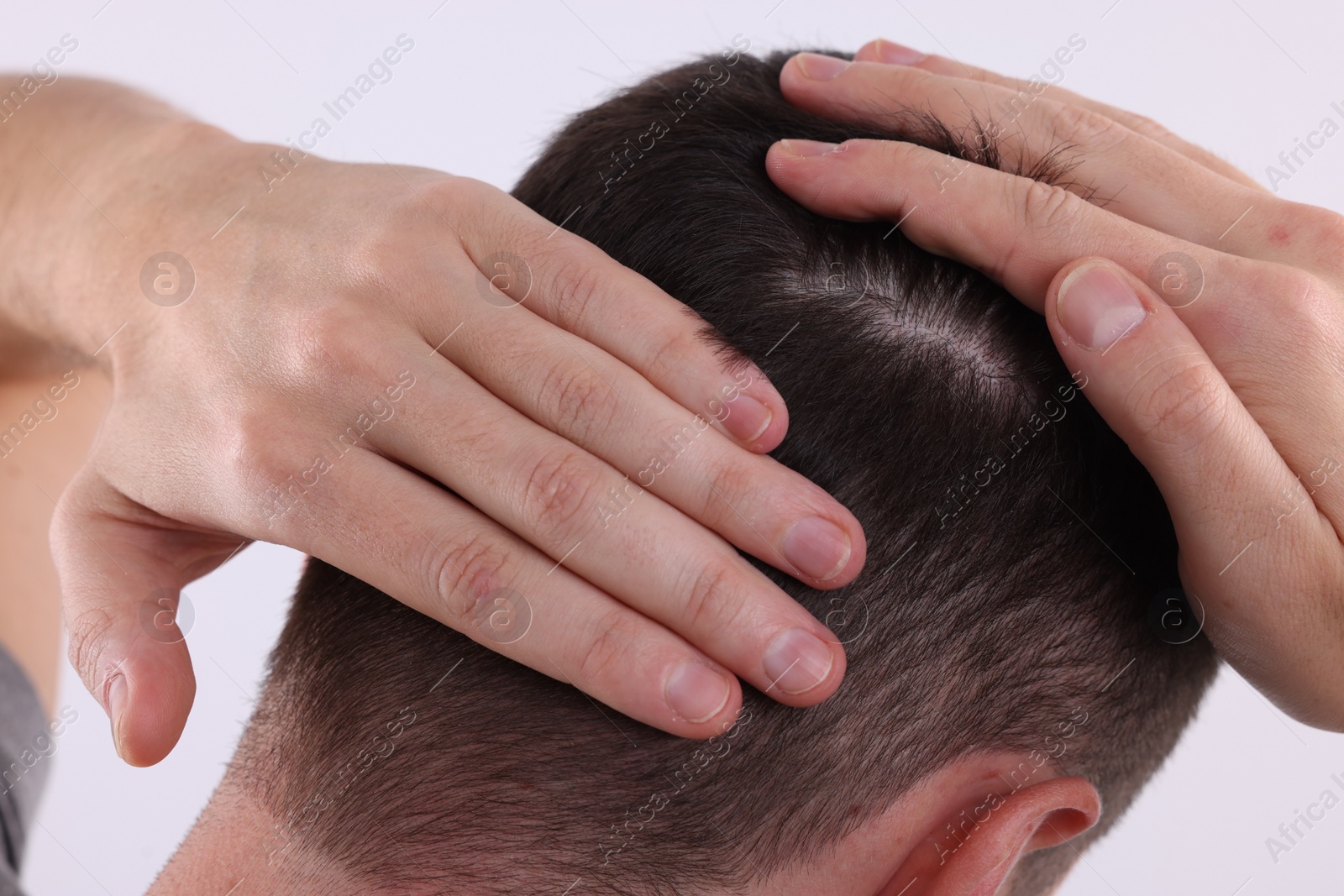 Photo of Man examining his hair and scalp on white background, closeup