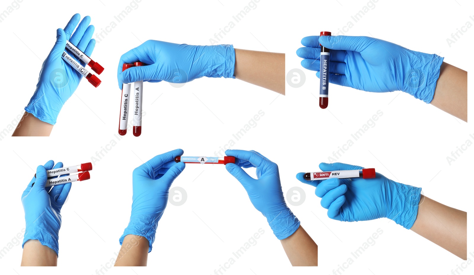 Image of Collage with photos of scientists holding test tubes with blood samples on white background, closeup