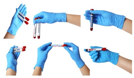 Collage with photos of scientists holding test tubes with blood samples on white background, closeup