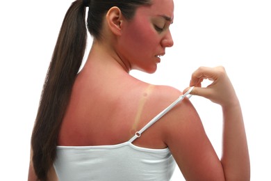 Photo of Woman with sunburned skin on white background