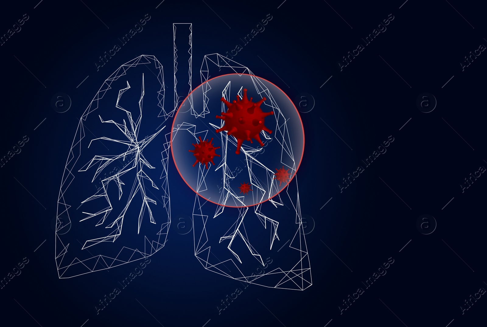 Illustration of  human lungs affected with disease on dark background