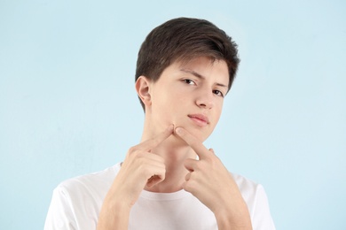 Photo of Teenage boy with acne problem on light background