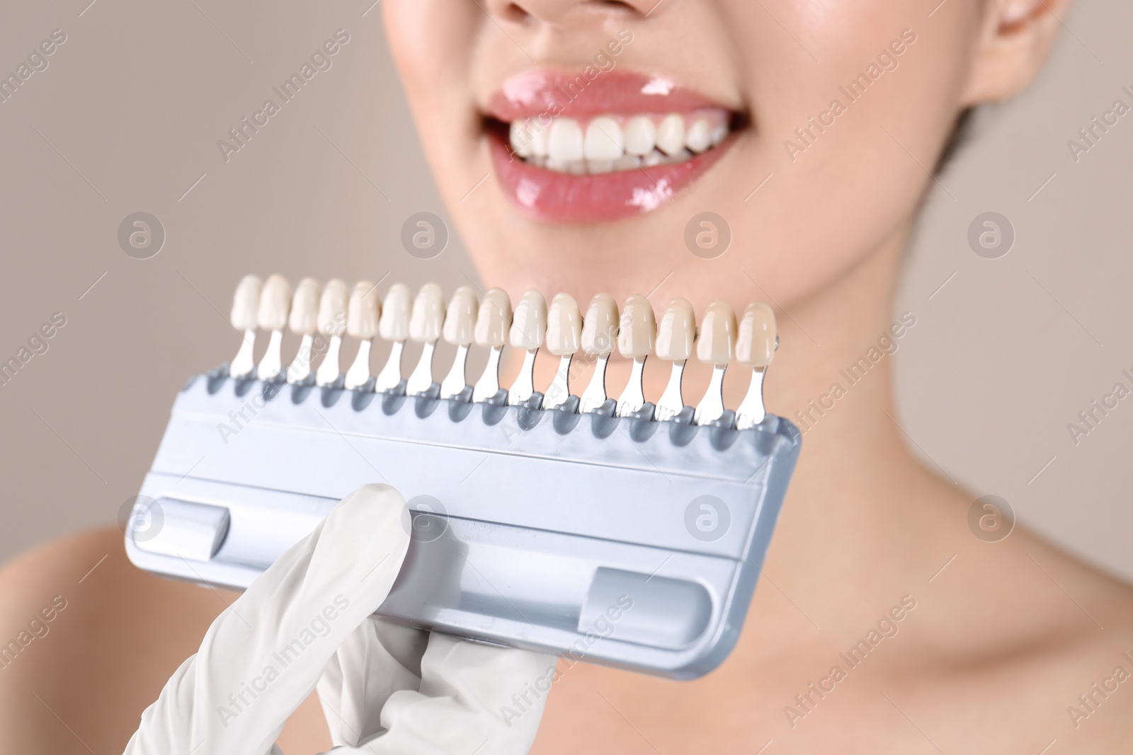 Photo of Dentist checking young woman's teeth color, closeup