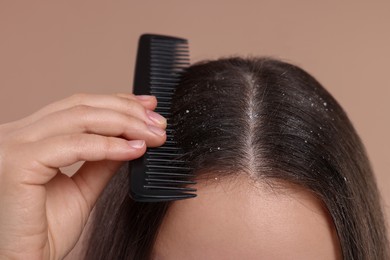 Photo of Woman with comb examining her hair and scalp on beige background, closeup. Dandruff problem