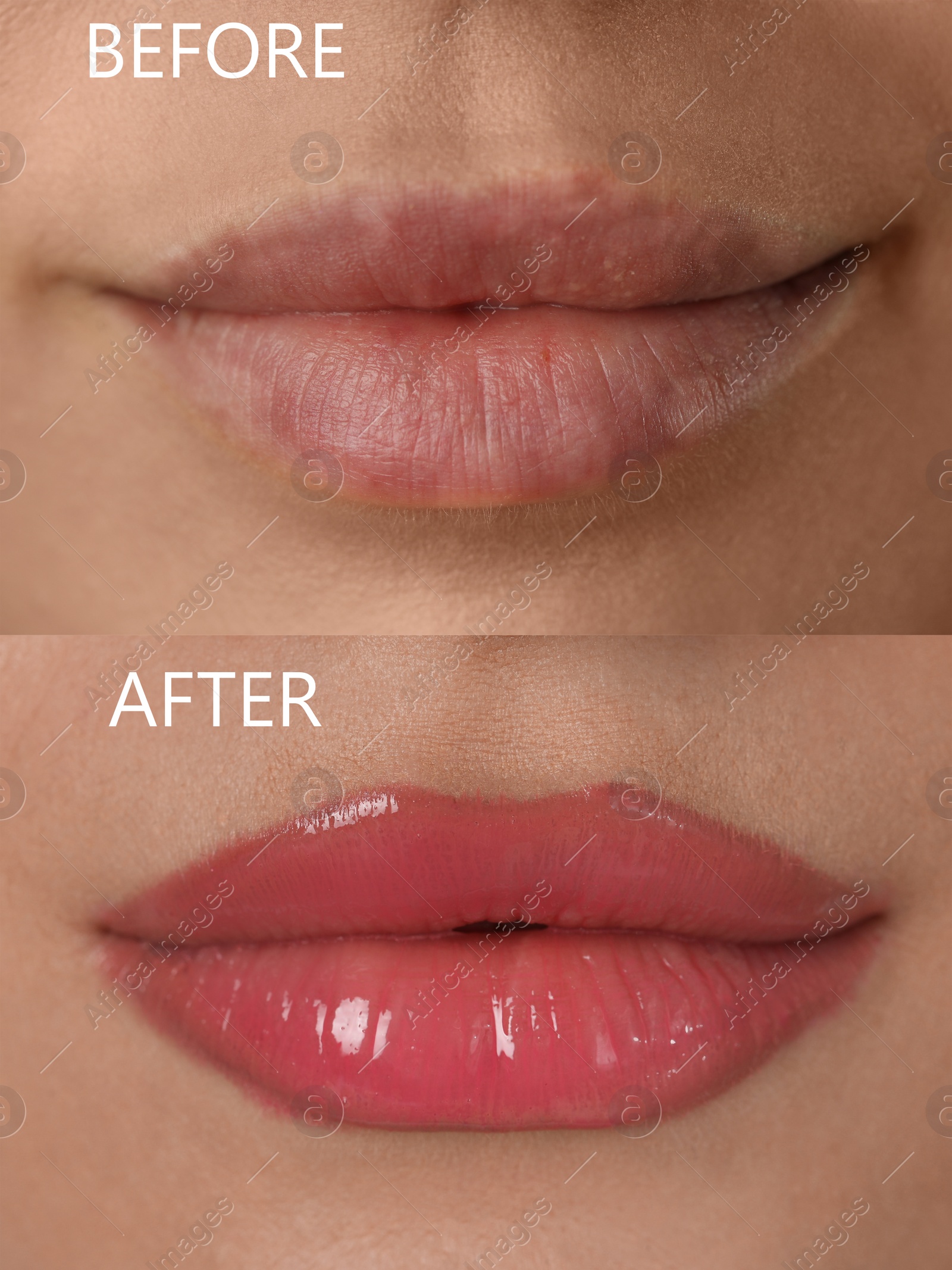 Image of Collage with photos of young woman before and after permanent lip makeup, closeup