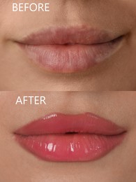 Collage with photos of young woman before and after permanent lip makeup, closeup