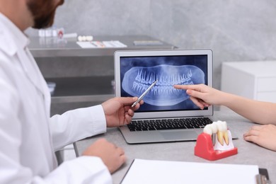 Photo of Doctor showing patient X-ray picture and educational model of dental implant in clinic, closeup