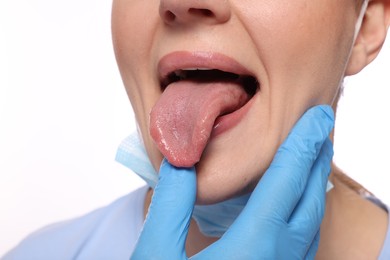 Doctor examining woman`s oral cavity on white background, closeup