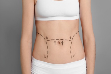 Photo of Young woman with marks on belly for cosmetic surgery operation against color background