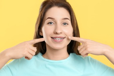 Photo of Smiling woman pointing at her dental braces on yellow background