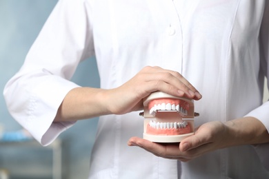 Photo of Dentist holding educational model of oral cavity with teeth in clinic, closeup