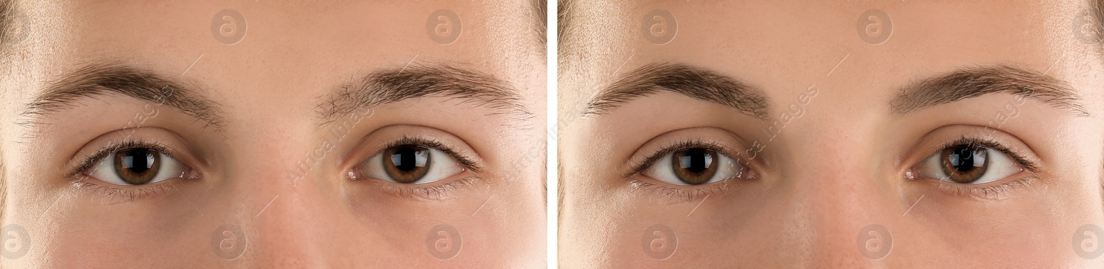 Image of Collage with photos of man before and after eyebrow modeling, closeup. Banner design