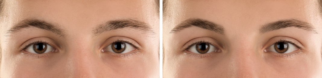 Image of Collage with photos of man before and after eyebrow modeling, closeup. Banner design