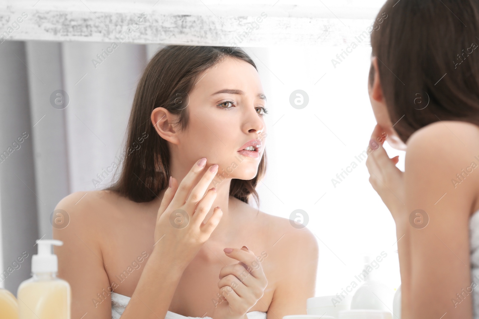 Photo of Teenage girl with acne problem looking in mirror indoors