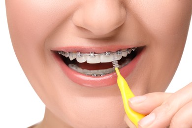 Smiling woman with dental braces cleaning teeth using interdental brush on white background, closeup