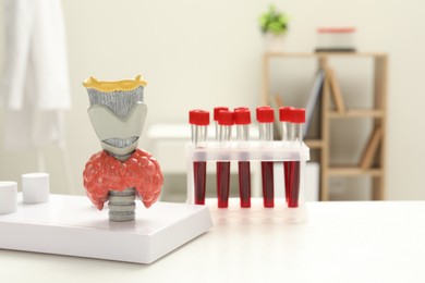 Photo of Endocrinology. Model of thyroid gland and samples of blood in test tubes on white table at clinic
