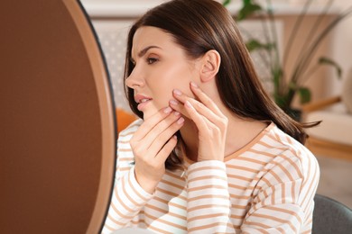 Photo of Young woman looking in mirror and squeezing pimple indoors. Hormonal disorders