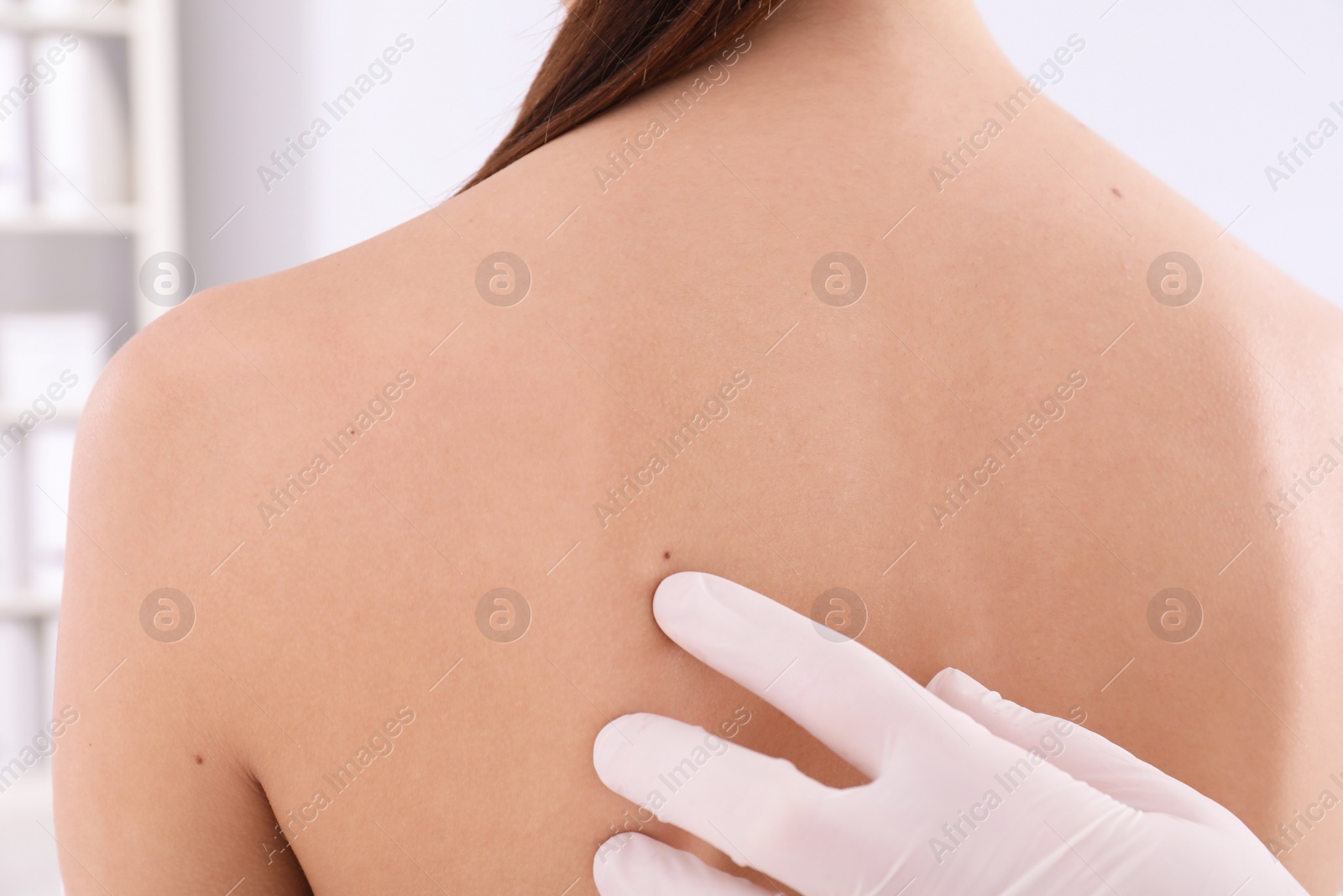 Photo of Dermatologist examining patient in clinic, closeup view