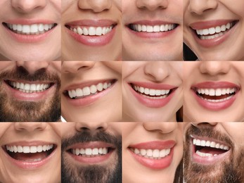 People showing white teeth, closeup. Collage of photos