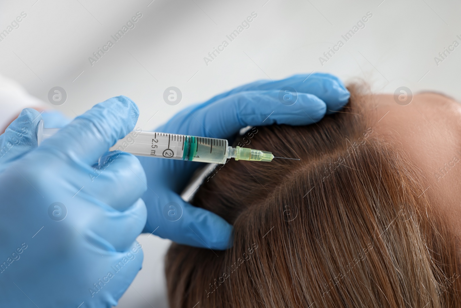 Photo of Trichologist giving injection to patient in clinic, closeup