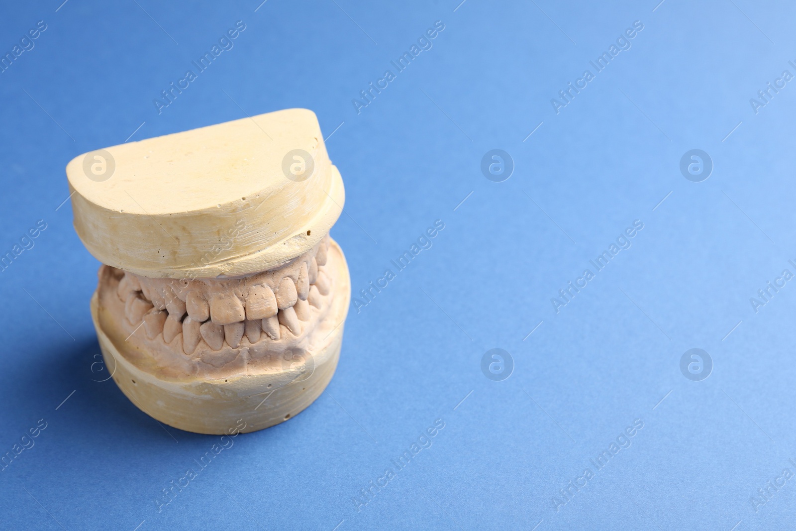 Photo of Dental model with gums on blue background, space for text. Cast of teeth