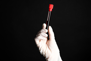 Photo of Scientist holding test tube with blood sample on black background, closeup. Virus research