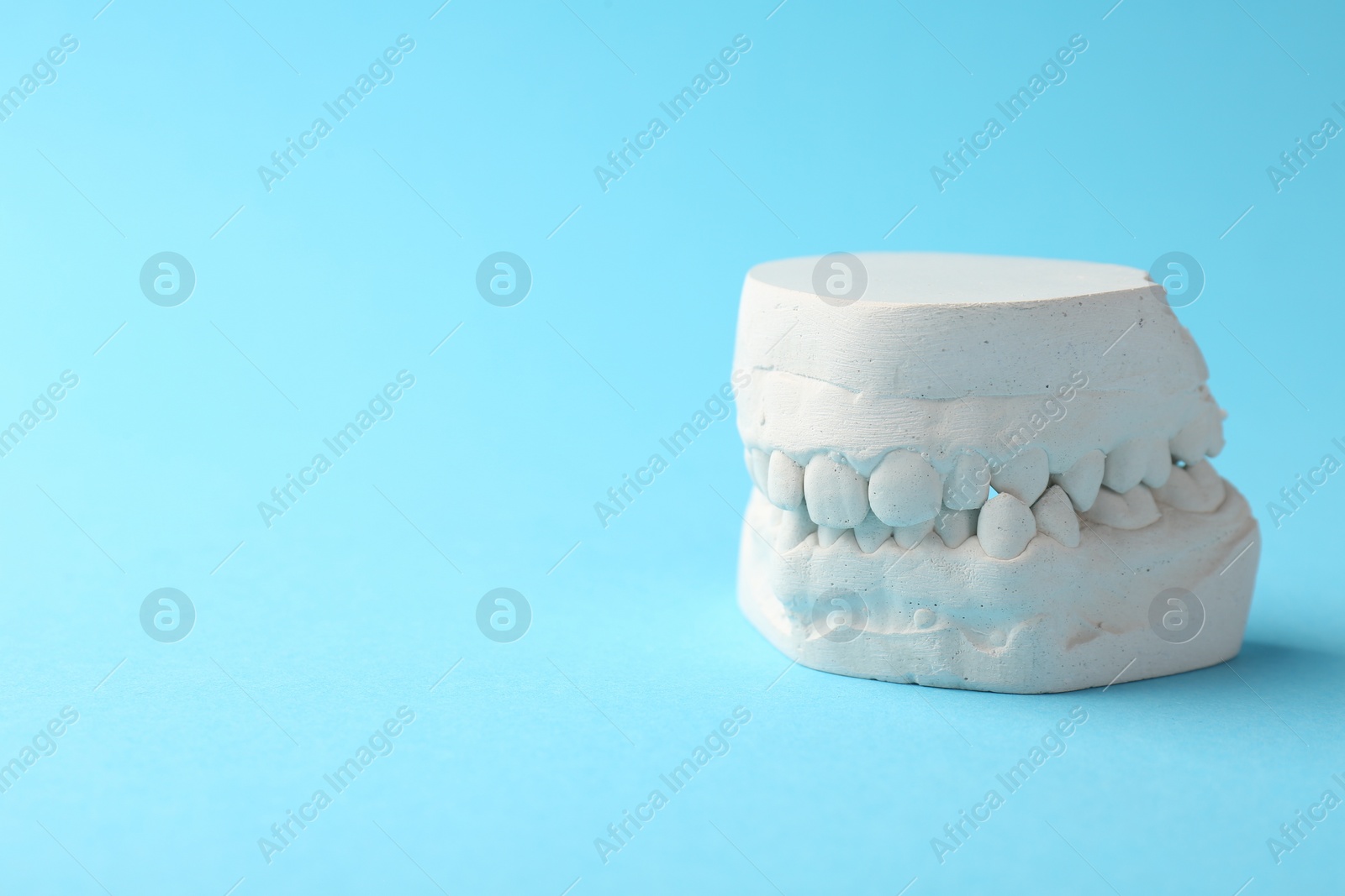 Photo of Dental model with gums on light blue background, space for text. Cast of teeth