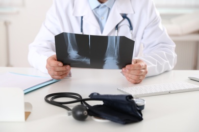 Photo of Orthopedist examining X-ray picture at desk in office, closeup