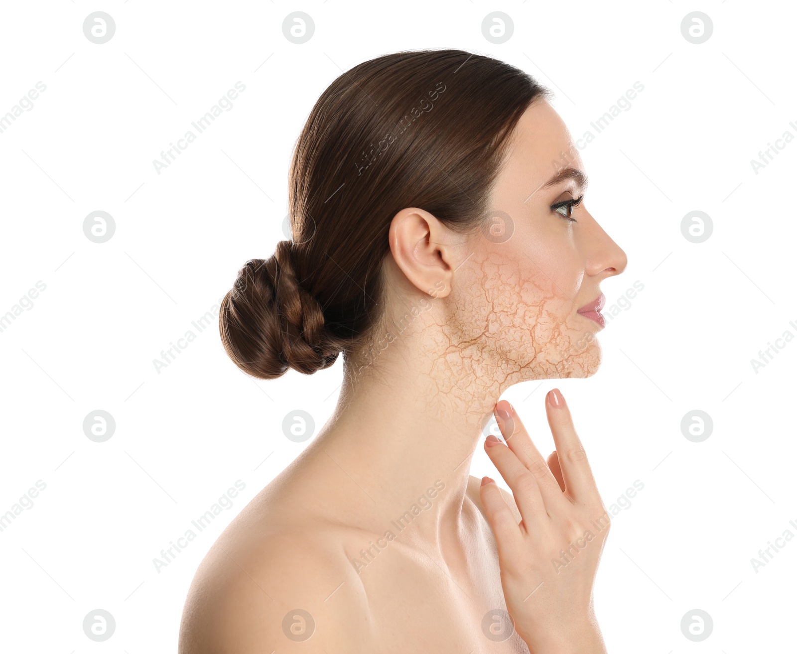 Image of Beautiful young woman with dry skin on white background