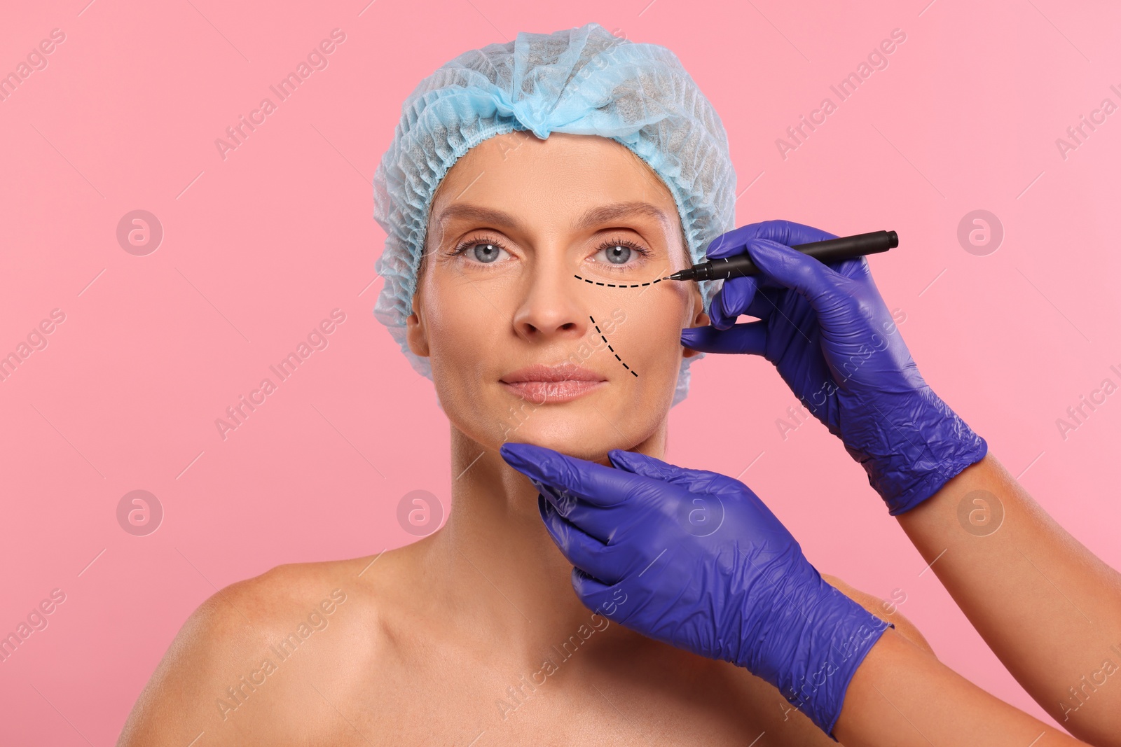 Image of Woman preparing for cosmetic surgery, pink background. Doctor drawing markings on her face, closeup