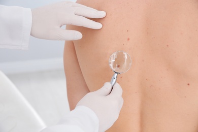 Dermatologist examining patient's birthmark with magnifying glass in clinic, closeup