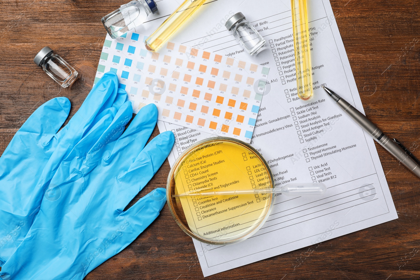 Photo of Flat lay composition with laboratory equipment and urine samples on wooden background. Urology concept