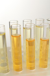 Photo of Tubes with urine samples for analysis on light grey background, closeup