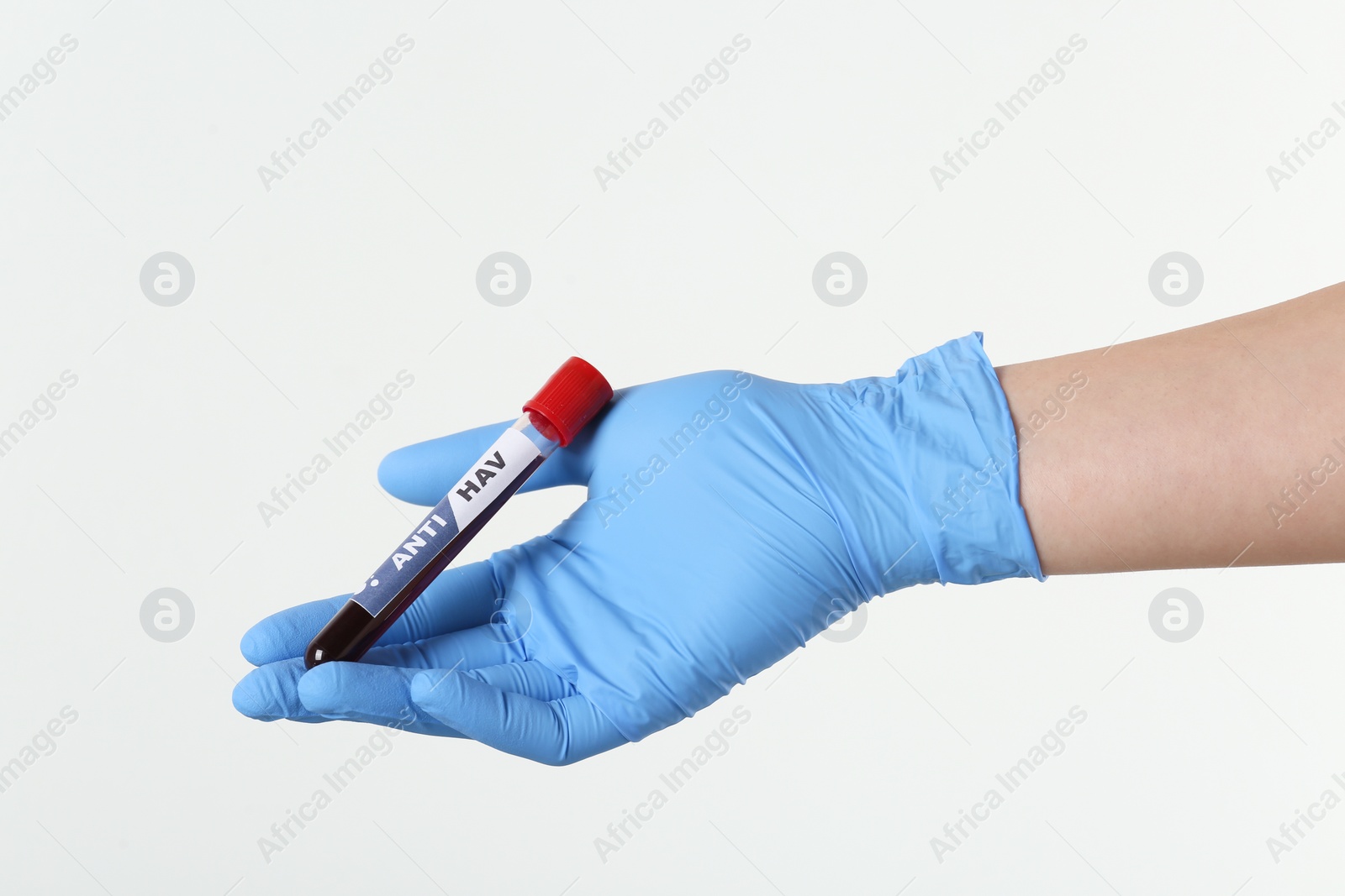 Photo of Scientist holding tube with blood sample and label ANTI HAV on light background, closeup