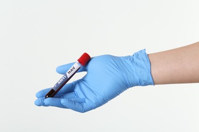 Scientist holding tube with blood sample and label ANTI HAV on light background, closeup