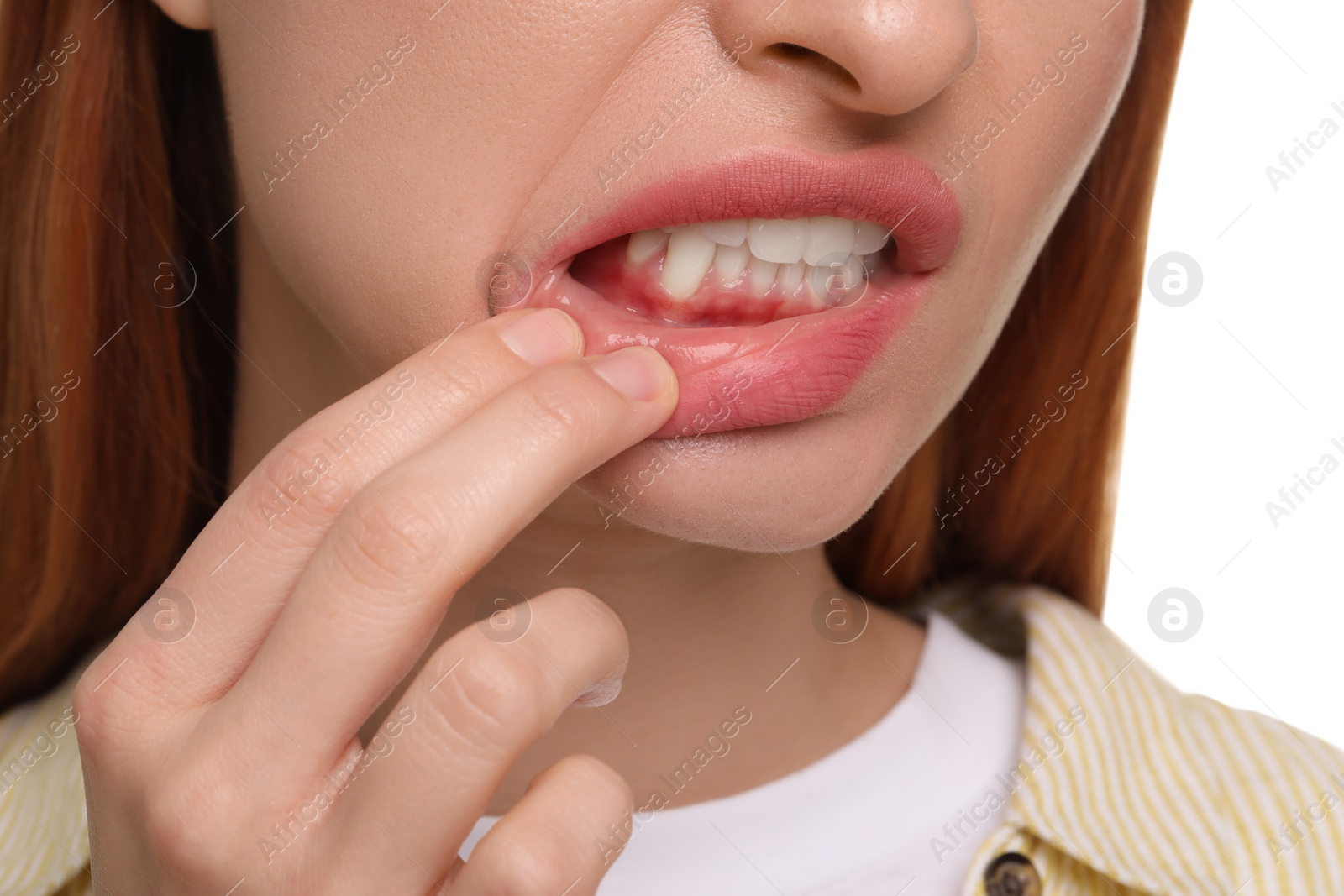 Photo of Woman showing her clean teeth on white background, closeup