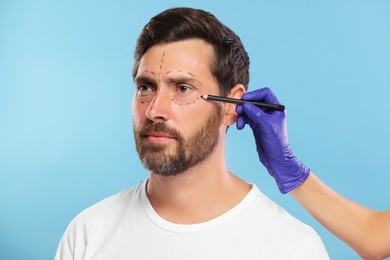 Doctor drawing marks on man's face for cosmetic surgery operation against light blue background