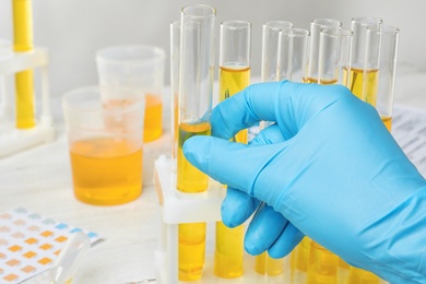 Photo of Laboratory worker taking test tube with urine sample from holder, closeup. Urology concept
