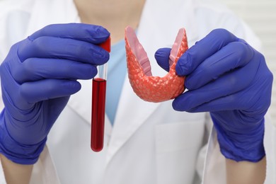 Photo of Endocrinologist showing thyroid gland model and blood sample in test tube, closeup