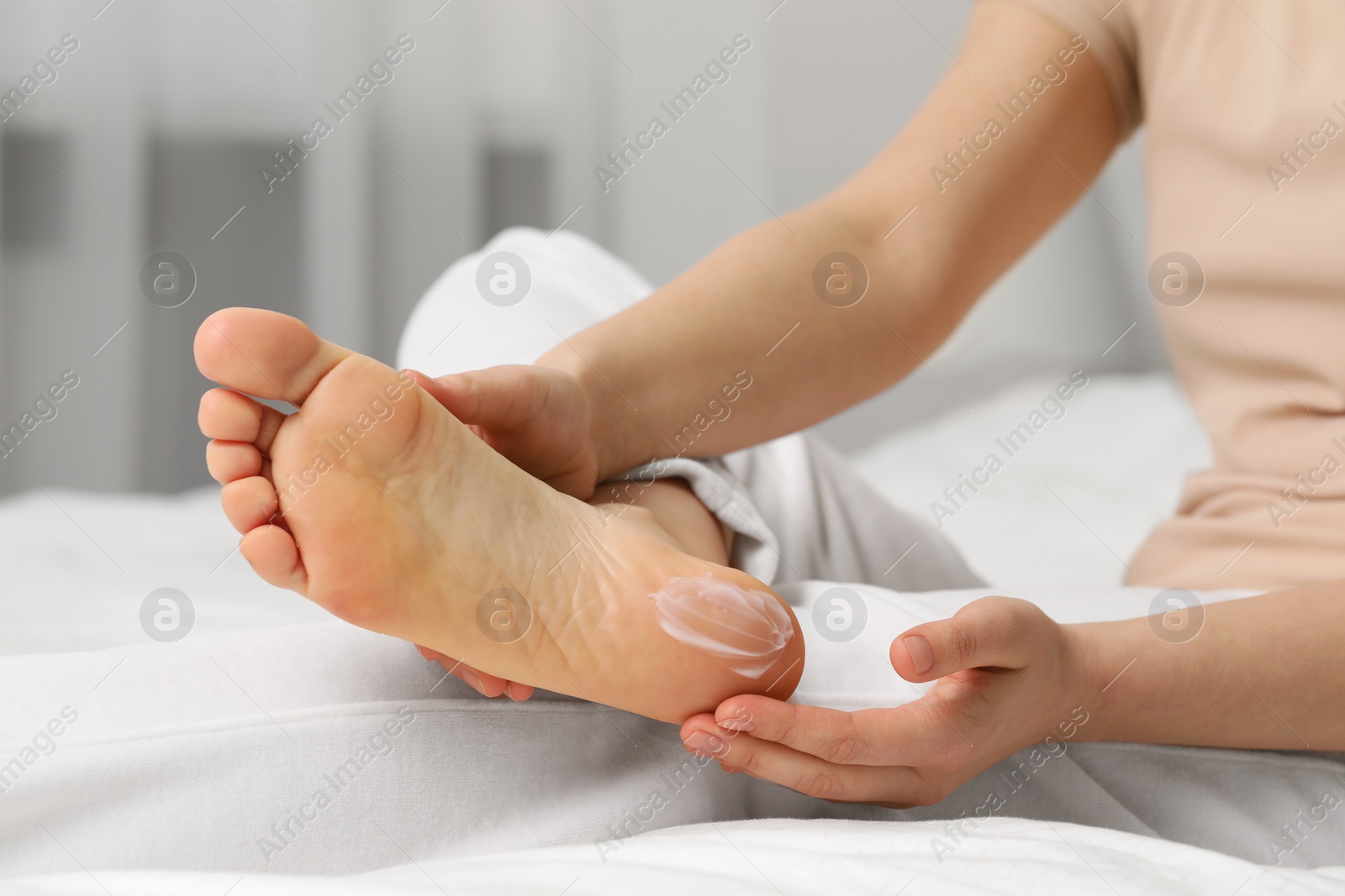 Photo of Young woman with dry skin applying cream onto her foot indoors, closeup