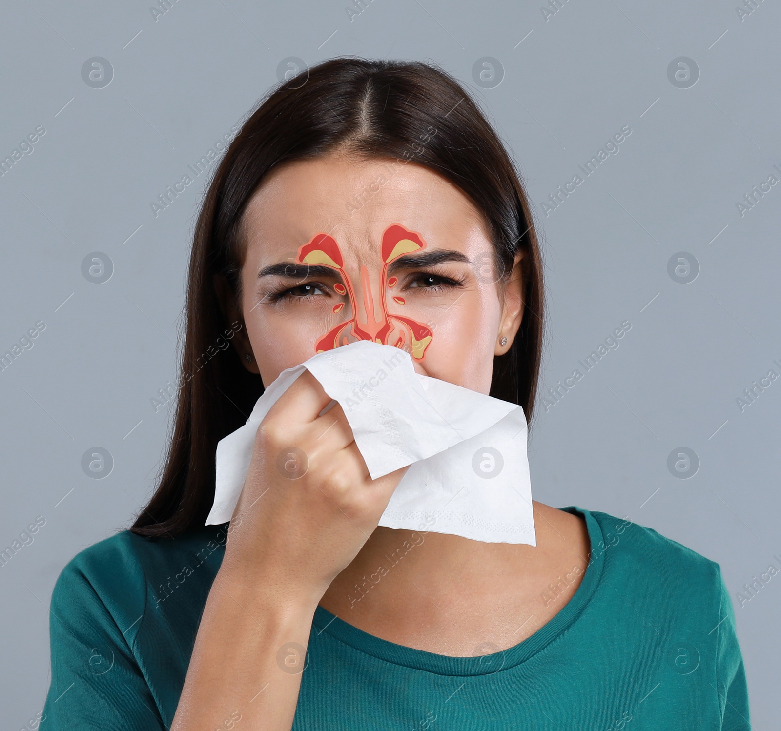 Image of Woman suffering from runny nose as allergy symptom. Sinuses illustration on face