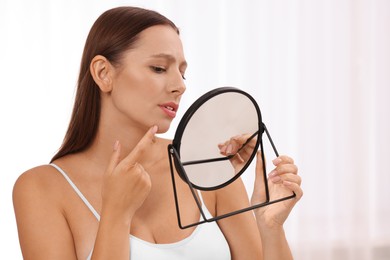 Woman with skin problem looking at mirror indoors