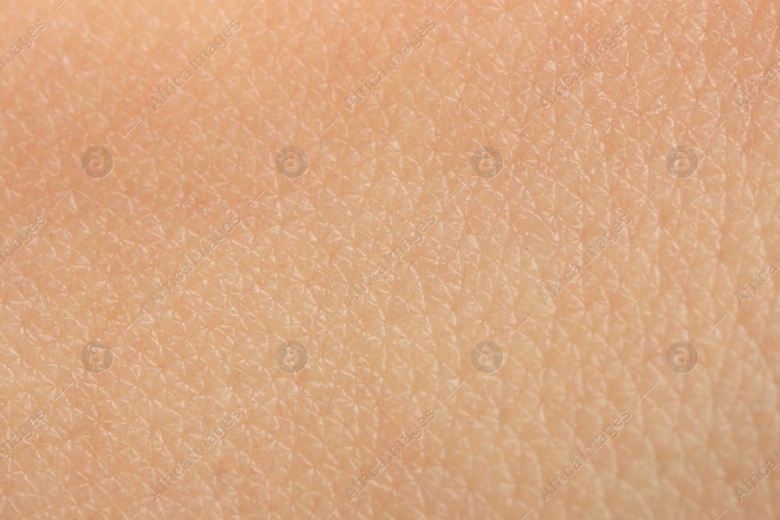 Photo of Texture of dry skin as background, macro view