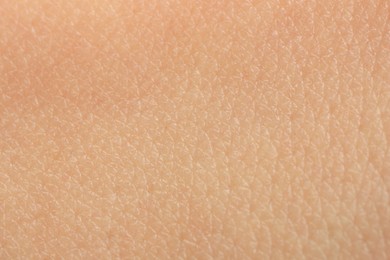 Photo of Texture of dry skin as background, macro view