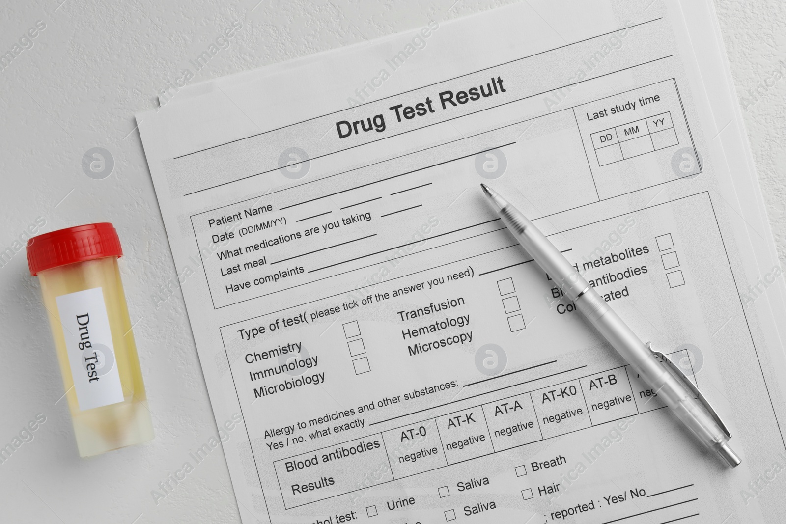 Photo of Drug test result form, container with urine sample and pen on light table, flat lay