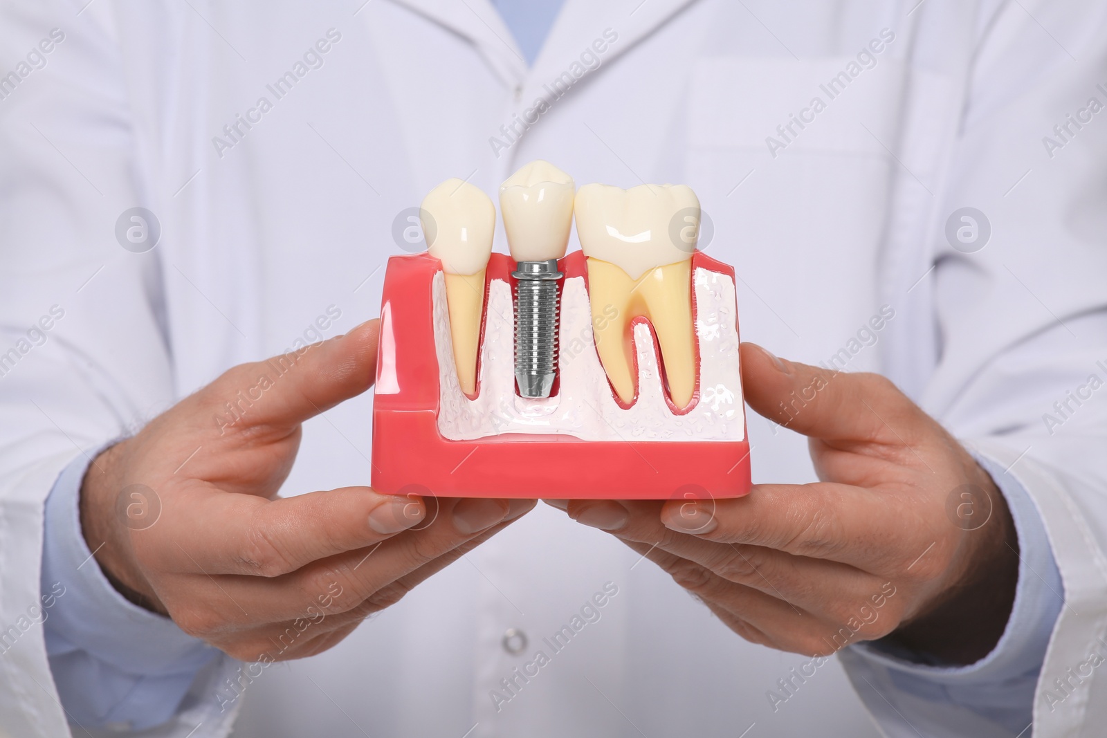 Photo of Dentist holding educational model of dental implant on white background, closeup